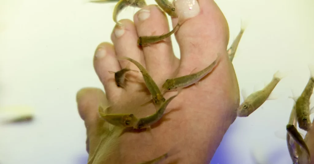 Garra Rufa aka Doctor fish therapy procedure, preparation, duration, and aftercare of Doctor Fish therapy.